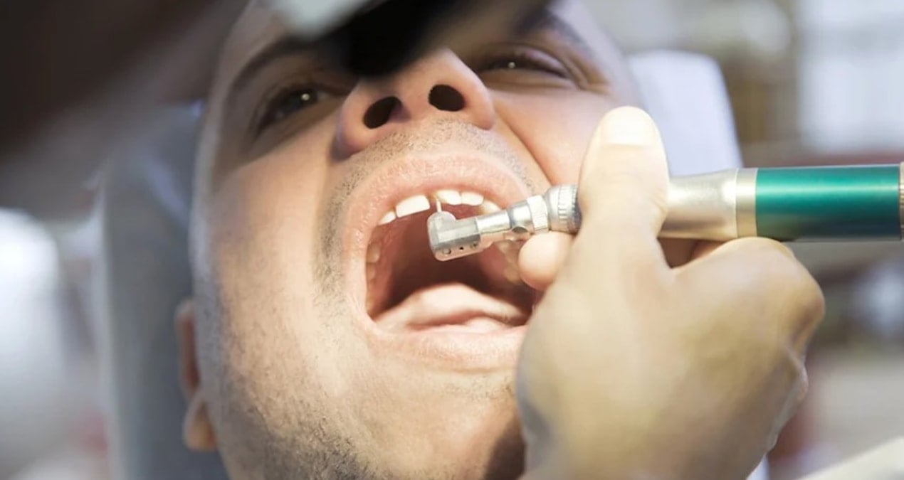 En az 1 dişi eksik 30 erkek aranıyor: İnsanlığı değiştirecek çalışma başladı