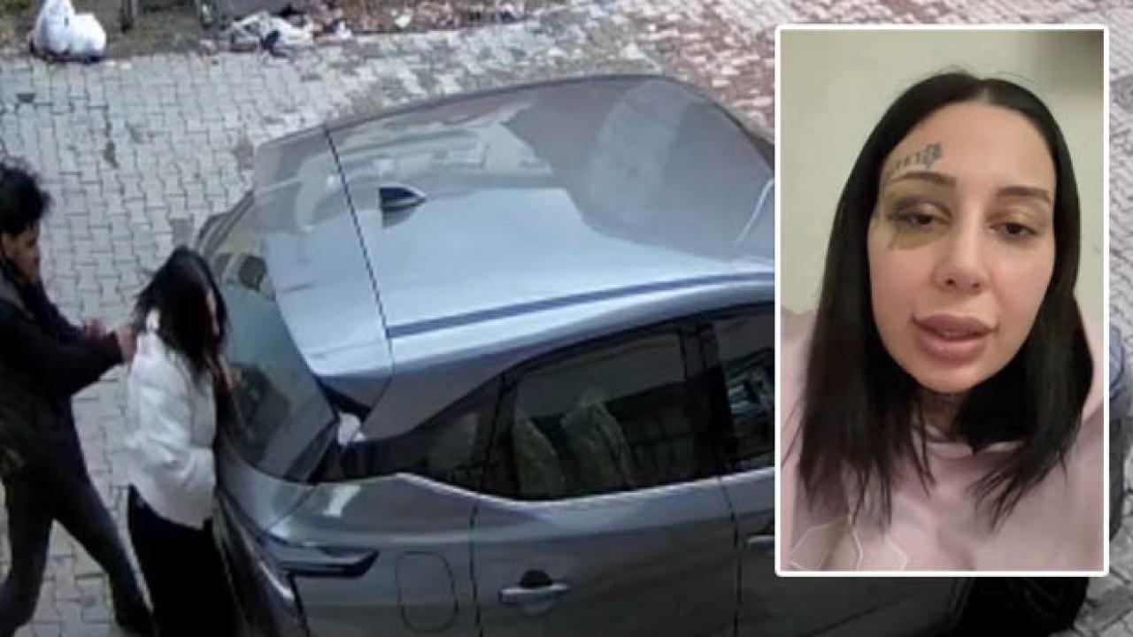 Kağıthane’de boşanma aşamasındaki eşi tarafından sokak ortasında darbedilen kadın konuştu